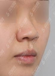 牛勇敢医生好不好？医生简介介绍，医生隆鼻案例简直完美到爆！