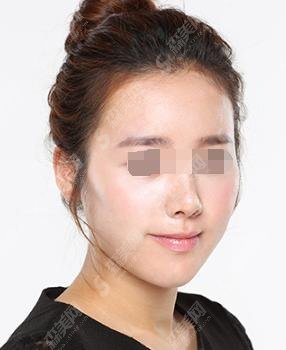 王阳医生怎么样?北京协和/整形案例简直惊艳广大网友!