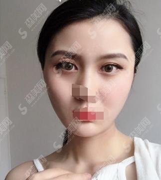 何照华医生怎么样?北京联合丽格+医生简介+案例分享