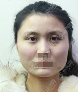 何照华医生怎么样?北京联合丽格+医生简介+案例分享