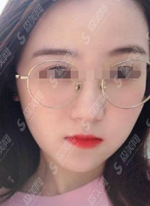 重庆华美潘宝华磨骨怎么样？医生介绍+医生案例+较新价格表