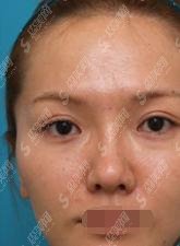 北京王世勇医生怎么样？修复双眼皮/医院介绍/医生介绍