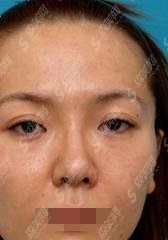 北京王世勇医生怎么样？修复双眼皮/医院介绍/医生介绍