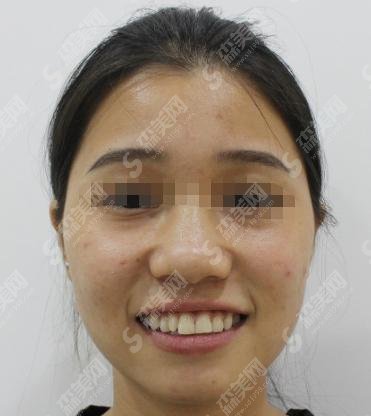 章丘口腔医院怎么样？牙齿矫正+韦娟医生的医生介绍