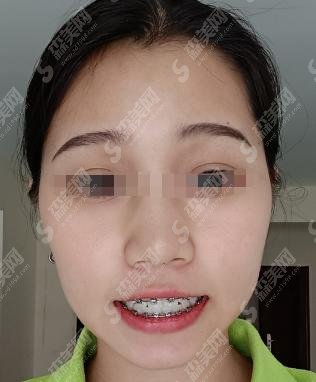 章丘口腔医院怎么样？牙齿矫正+韦娟医生的医生介绍