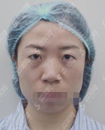 十堰太和医院整形科徐凤瑞医生怎么样？医院介绍，附医生详情