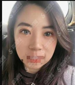 十堰太和医院整形科徐凤瑞医生怎么样？医院介绍，附医生详情