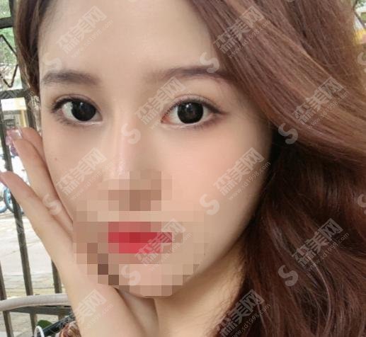 汕头悦美荟整形美容医院怎么样?医院介绍—医院医生分享—案例展示