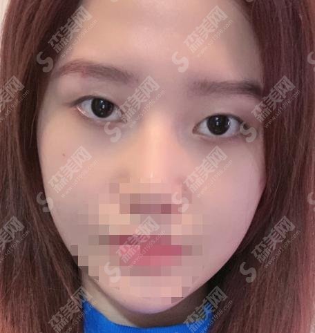 汕头悦美荟整形美容医院怎么样?医院介绍—医院医生分享—案例展示