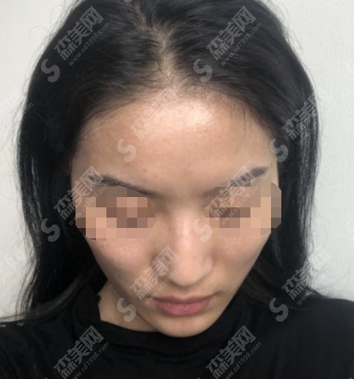 青海省人民医院整形科较新情况一览！医院的介绍和医生的简介附在文中！