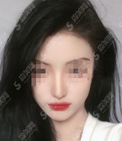 青海省人民医院整形科较新情况一览！医院的介绍和医生的简介附在文中！