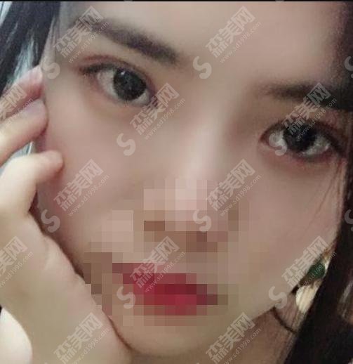 兰大二院整形外科医院怎么样?医院简介/医生介绍/案例分享