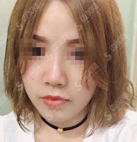 南京市妇幼保健院整形美容科怎么样？美容科简介/医生简介