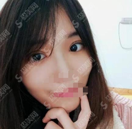 铜仁人民医院整形科医院怎么样?医院简介—医生详情—案例分享