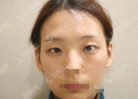 铜仁人民医院整形科医院怎么样?医院简介—医生详情—案例分享