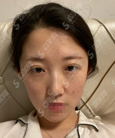 枣阳市第一人民医院整形美容科怎么样？医生怎么样?附相关案例分享