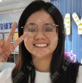 郑州泰康拜博口腔医院是正规医院吗？马贺医生和牙齿矫正恢复果图！