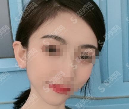 哈尔滨植发医院推荐!哈一大医院实力超群!附医生介绍