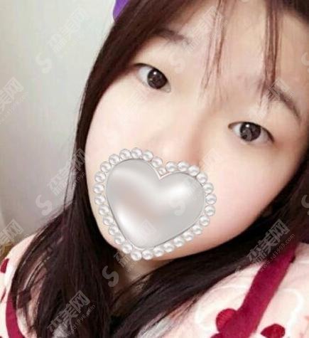 兰州整形医院排名前三的医生推荐，张瑾/刘萍/罗梅实力上榜
