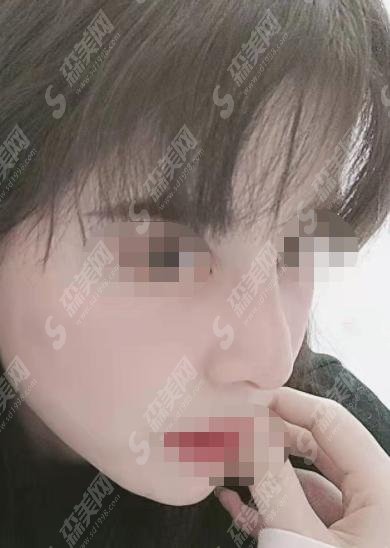 怀化市第一人民医院整形外科怎么样？隆鼻果值得去+医院介绍