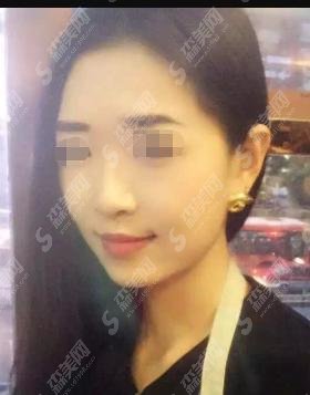 南京鼓楼医院集团宿迁市人民医院整形科怎么样?医生介绍&手术案例就在文章当中!