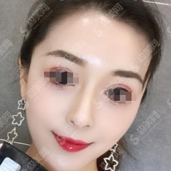 南京鼓楼医院集团宿迁市人民医院整形科怎么样?医生介绍&手术案例就在文章当中!