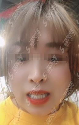 成都武侯众尚口腔医院何利邦医生怎么样？较新牙齿矫正案例分享+医生介绍