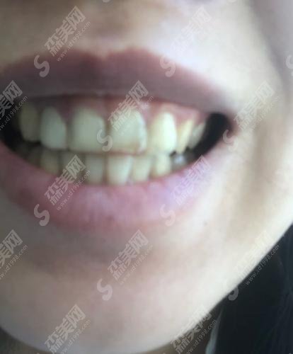 成都武侯众尚口腔医院何利邦医生怎么样？较新牙齿矫正案例分享+医生介绍