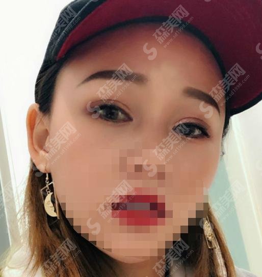 郴州市第一人民医院医学整形美容科怎么样?医生介绍和手术案分享给大家!