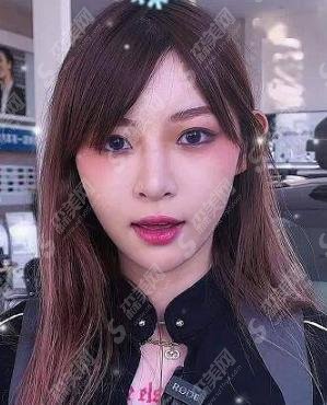 痞幼整容前照片曝光！为什么跟现在差距这么大！