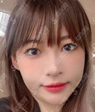 痞幼整容前照片曝光！为什么跟现在差距这么大！