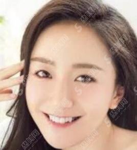 肖燕整过容吗？前后照片曝光！