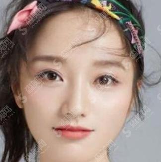 肖燕整过容吗？前后照片曝光！