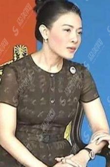 西拉米整容年轻时图片曝光！跟现在比堪称两人？