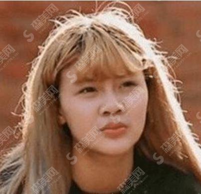 韩安冉取出下巴假体？对她的颜值影响大吗？