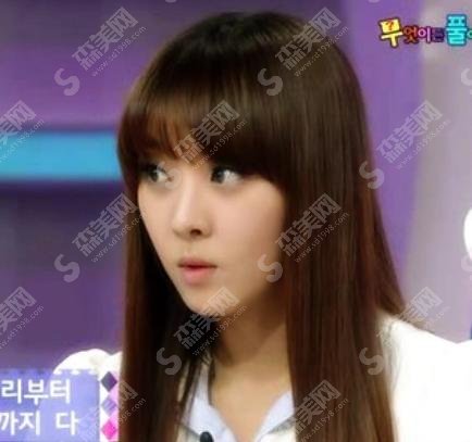 narsha整容?真的有整容吗?