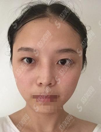 胡琼华医生的技术是有口皆碑的，胡琼华医生所在的上海第二医科大学详细介绍！