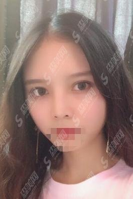 胡琼华医生的技术是有口皆碑的，胡琼华医生所在的上海第二医科大学详细介绍！