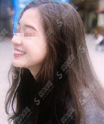 口腔医院是较为靠谱的医院,牙齿种植手术案例就能明X看出种植果好不好!