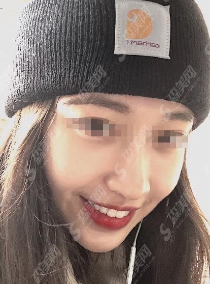 口腔医院是较为靠谱的医院,牙齿种植手术案例就能明X看出种植果好不好!