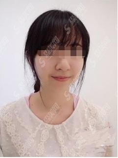 彩光嫩肤手术多少钱?有哪些因素导致的价格?附嫩肤案例分享过程曝光!