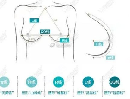 琴面假体隆胸手术费用是多少钱？假体隆胸的果好不好？附隆胸案例分享