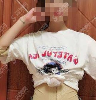 腰部吸脂减肥术?厉害吗?果怎么样?