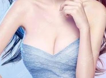 妙桃琴面假体隆胸怎么样?隆胸果+隆胸材料接收