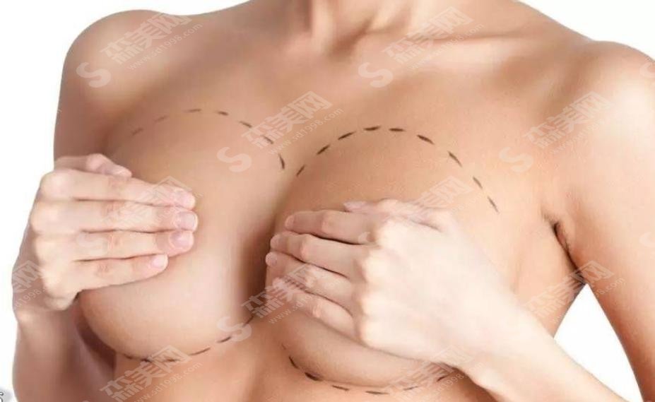 妙桃琴面假体隆胸怎么样?隆胸果+隆胸材料接收