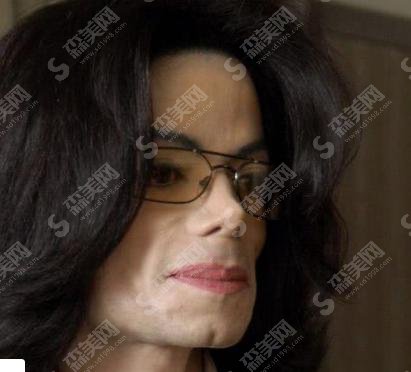 迈克尔杰克逊整过容吗？为什么都说他为较脆弱的鼻子+隆鼻价格分享