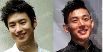 刘亚仁整过容吗?网友爆出整过鼻子是真的假的?