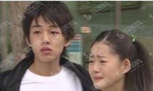 刘亚仁整过容吗?网友爆出整过鼻子是真的假的?