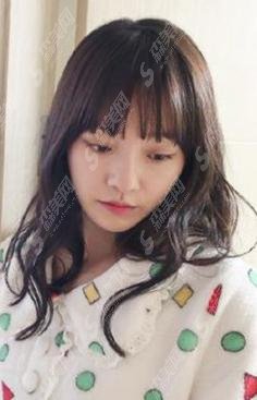 朴珪瑛整容过吗？整容爆料！附价格表