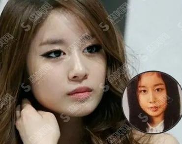 朴智贤整容前后对比！个人资料曝光+项目价格表